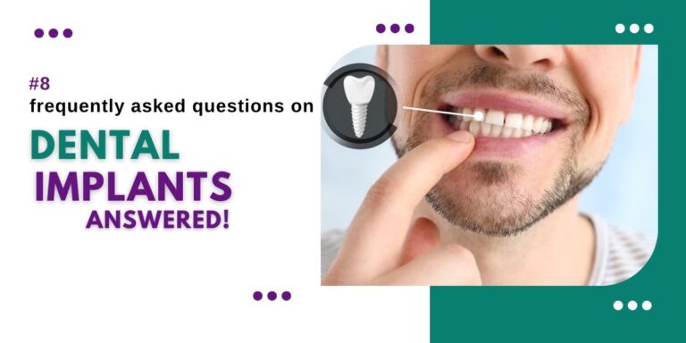 #8 frequently asked questions on dental implants answered!