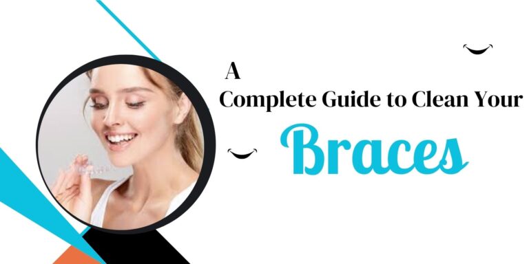 A Complete Guide to Clean Your Braces